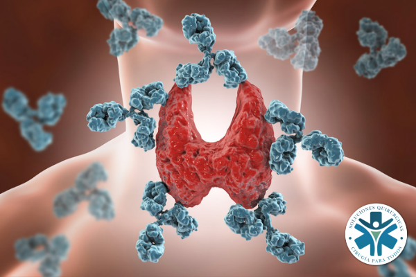 Pacientes que presentan alguna enfermedad de tiroides pueden ser más vulnerables a los efectos del virus y sufrir más complicaciones si presentan Covid-19.