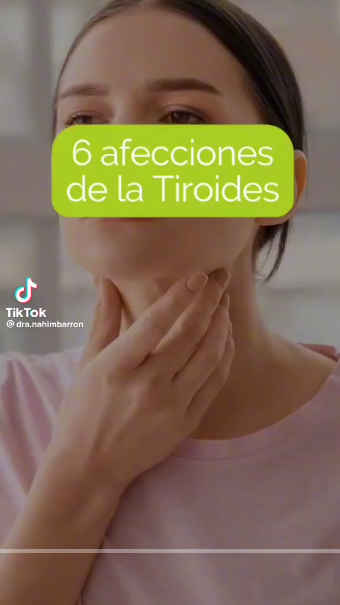 6 afecciones de la tiroides