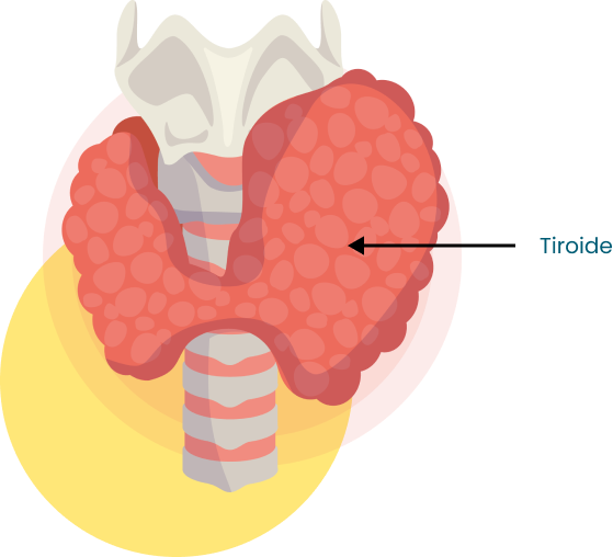 Tiroides